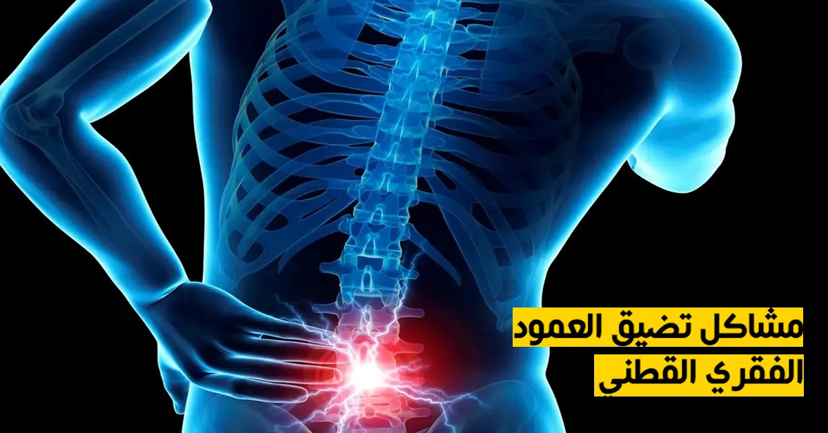 مشاكل تضيق العمود الفقري القطني